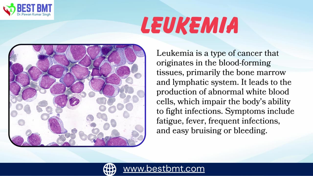 Understanding Symptoms and Treatments of Leukemia