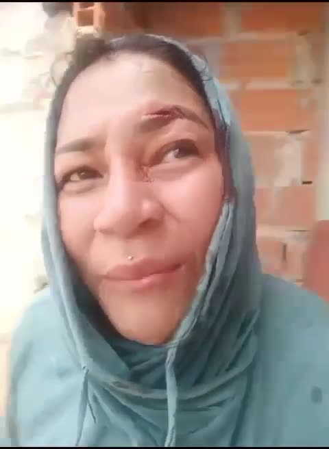 Personas lesionadas durante desalojo de viviendas en Pinar del Río