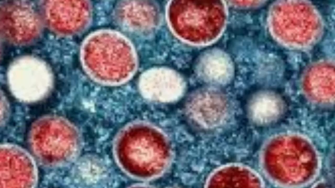 Sweden Reports First Case of New Mpox Variant Outside Africa