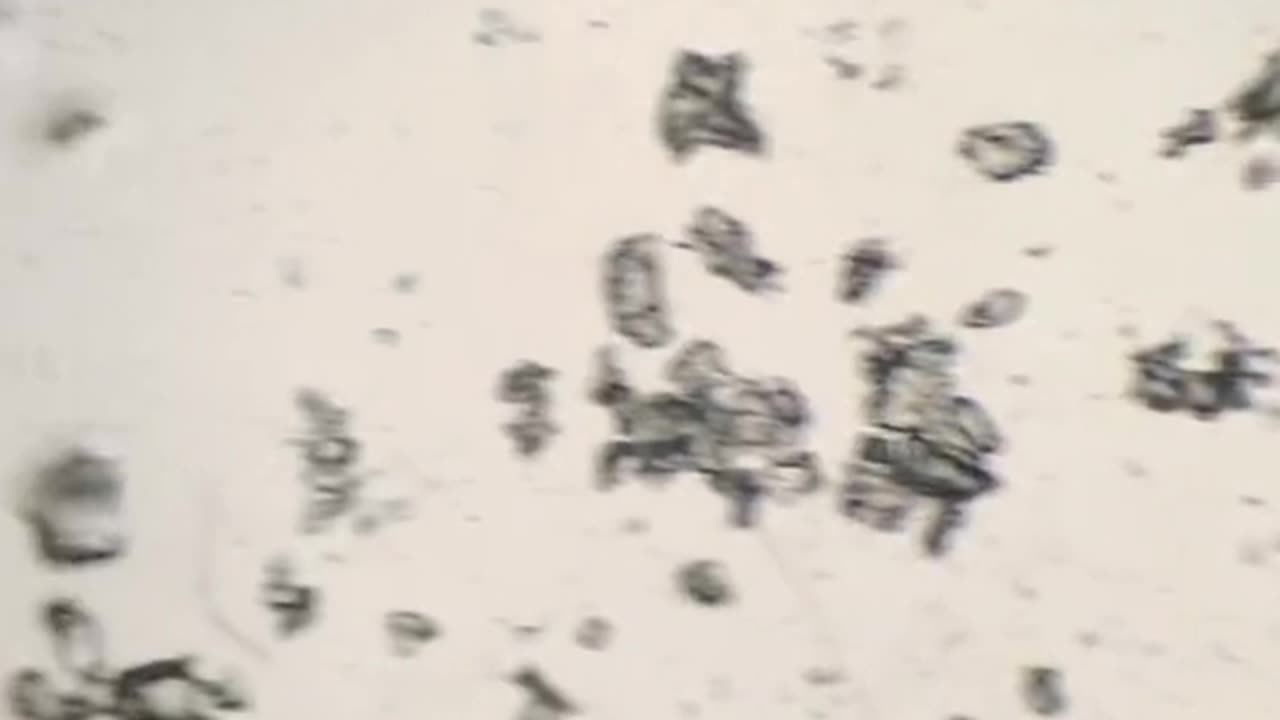 Would you still eat sugar cubes after seeing them magnified 400 times under a microscope