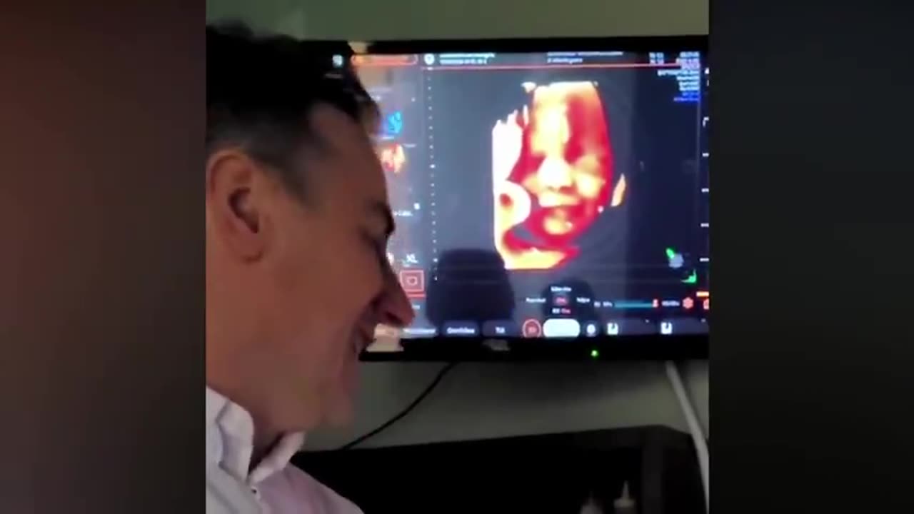 Unborn Baby Smiles at Dad’s Voice.