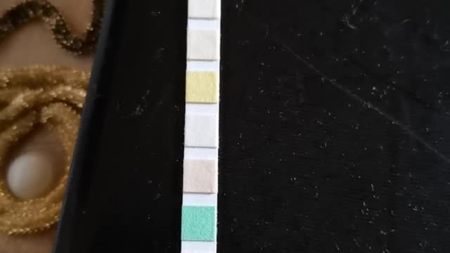 Acetone in urine detected by This strip, diabetes