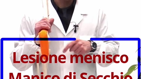 Lesione del Menisco a Manico di Secchio