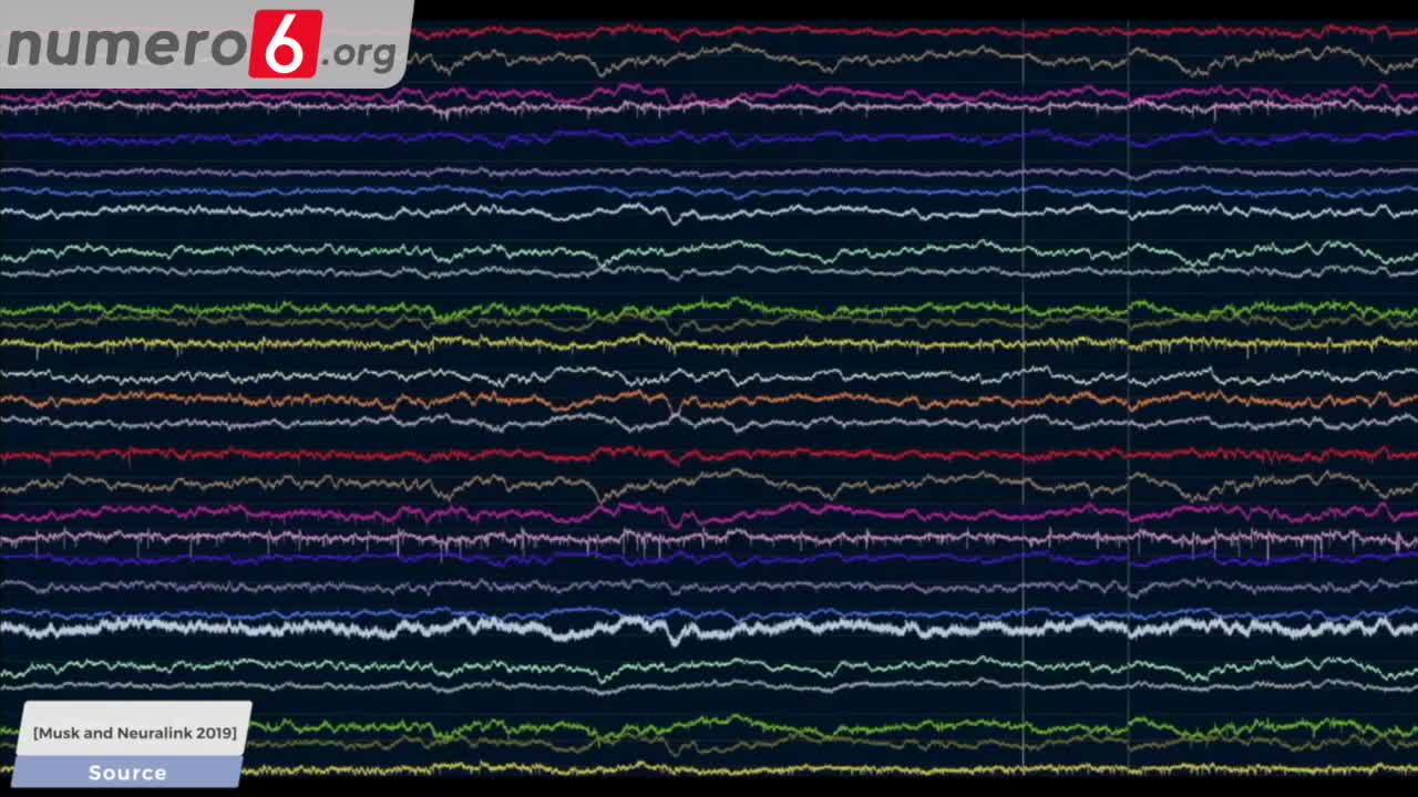 119 Neuralink di Elon Musk