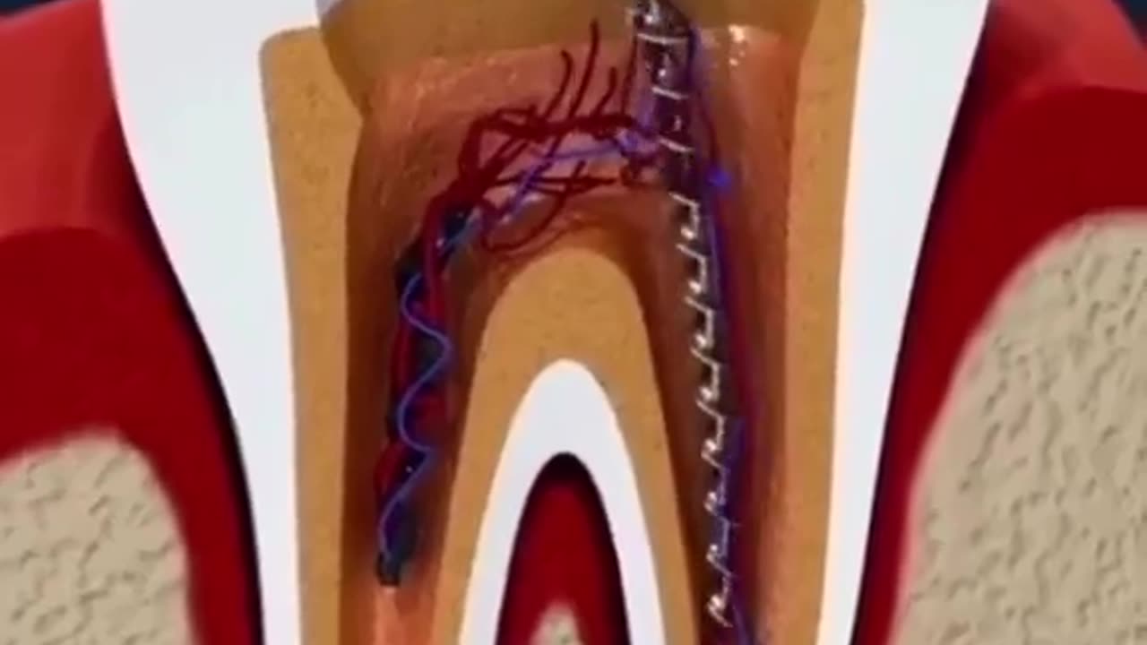 Amazing tooth restoration video