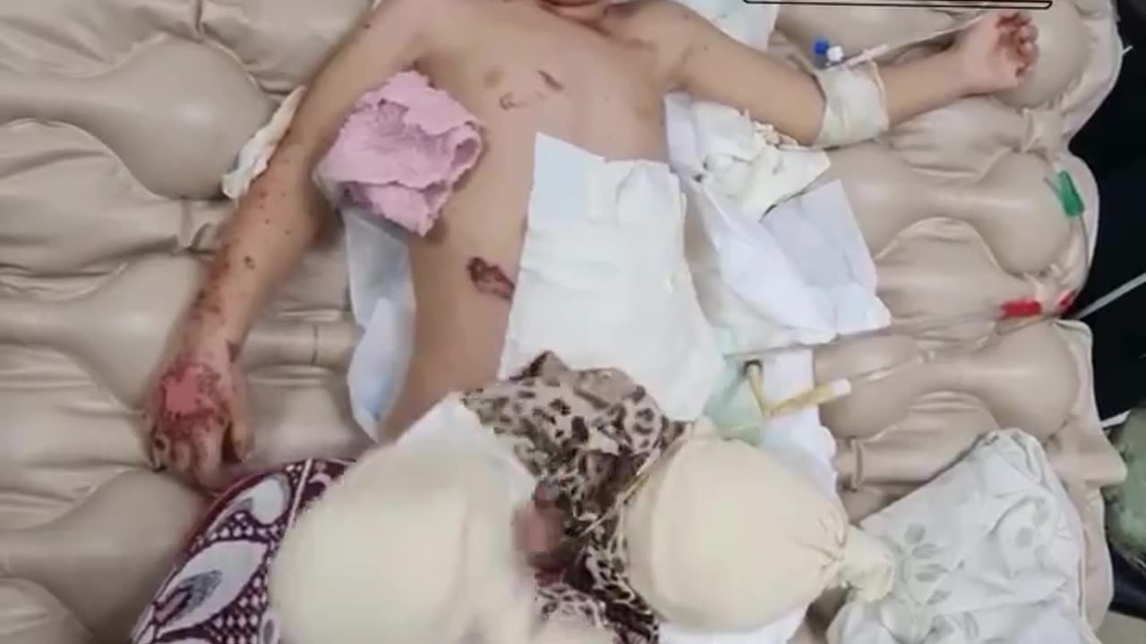 Three-year-old Hanan al-Duqqi lost her mother and both her legs in an Israeli airstrike