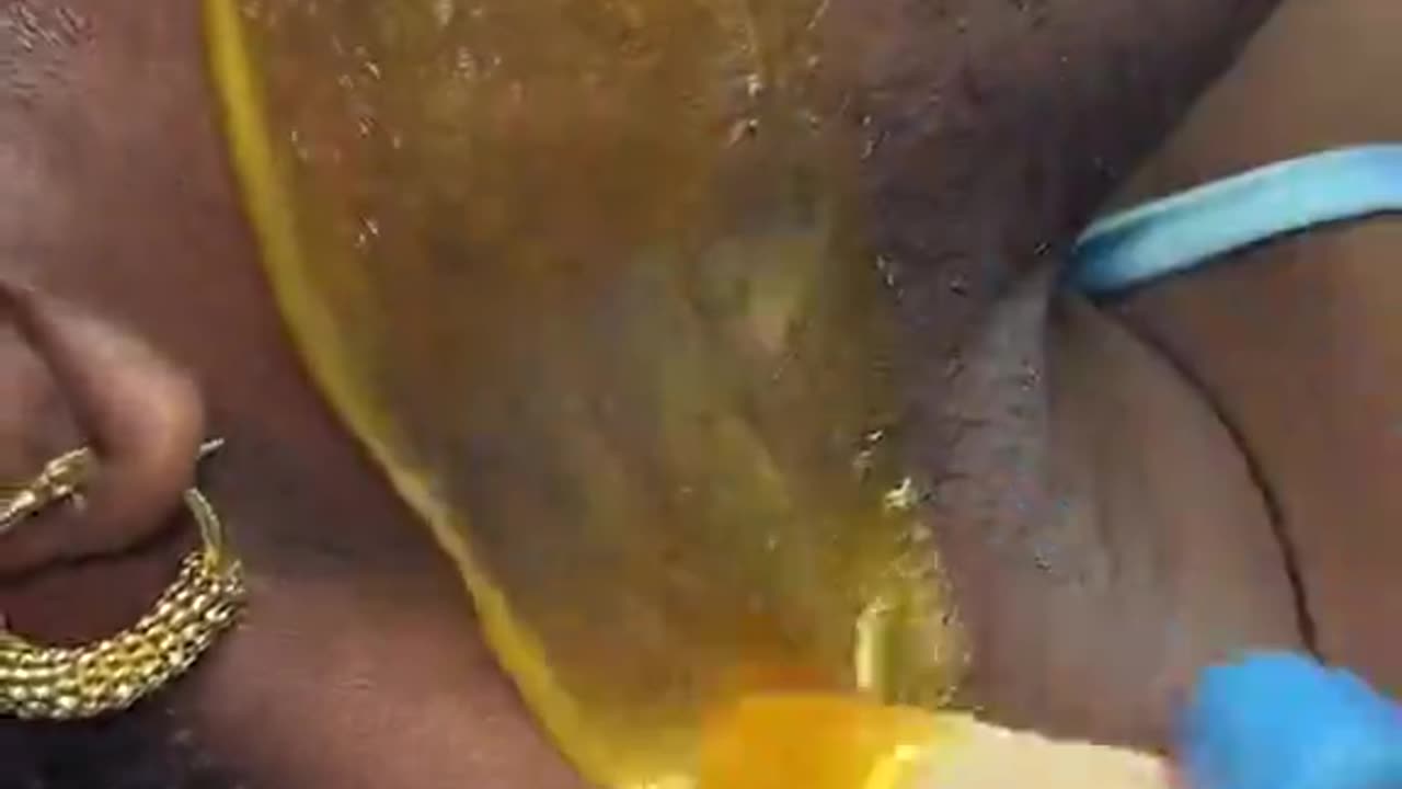 Expert Facial Waxing for Thick Hair | Waxing Queen Adventures