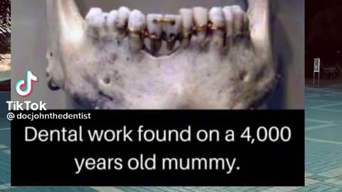 DENTAL WORK FOUND ON A 4,000 YR OLD MUMMY ~ANCIENT FIXED BRIDGE