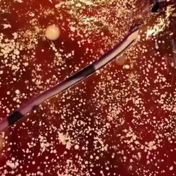 ⚠️MASCARILLAS : CULTIVOS DE BACTERIAS Y HONGOS.