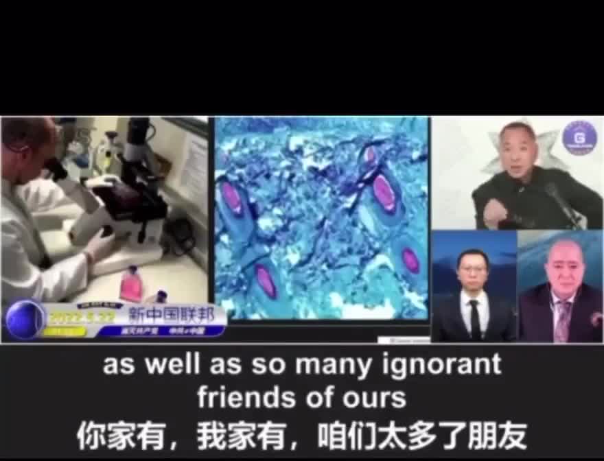 猴痘是疫苗的結果
