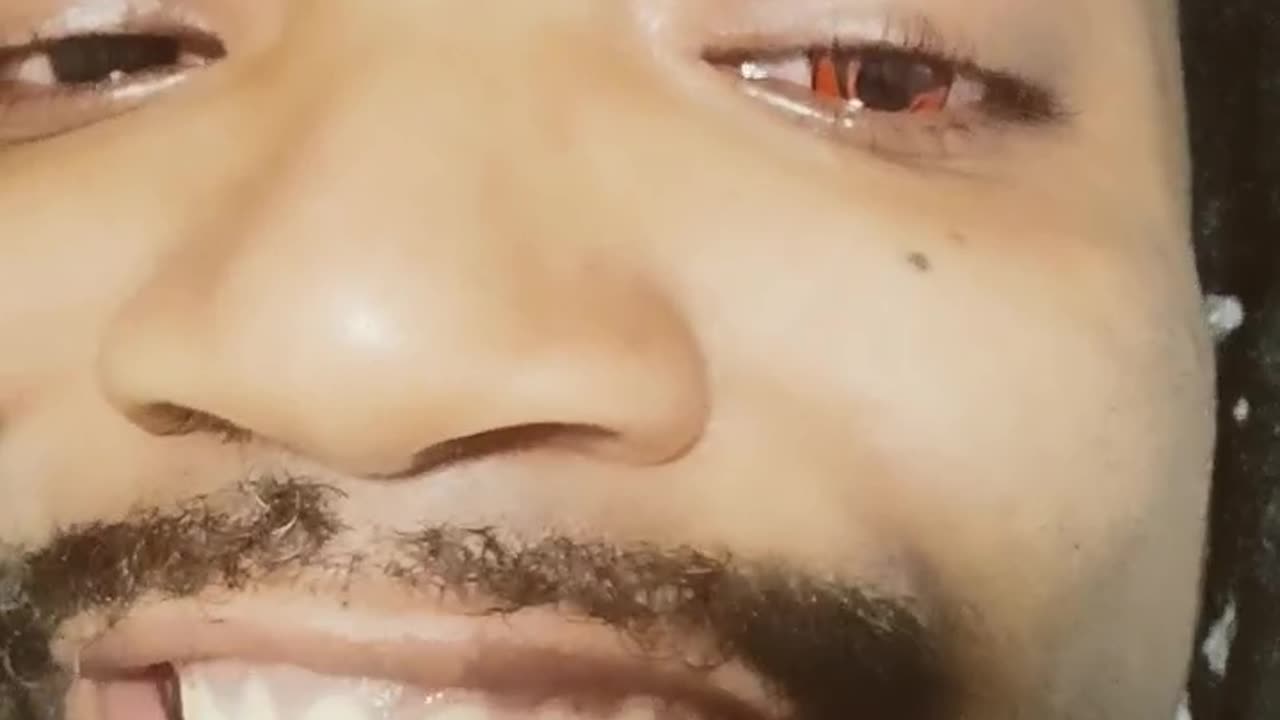Sharingan IRL ! Guess Who's Eyes I Took
