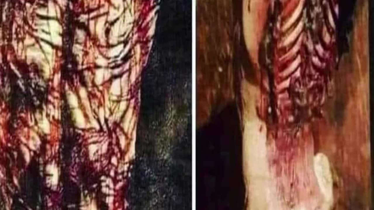 With His Wounds We Are Healed! Isaiah 53:5