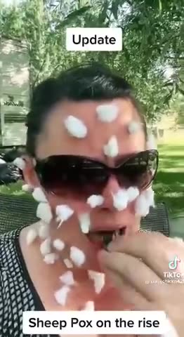 WELL THE SHEEP POX IS HERE AGAIN. BE SURE TO GET ALL YOUR BOOSTERS 🐑