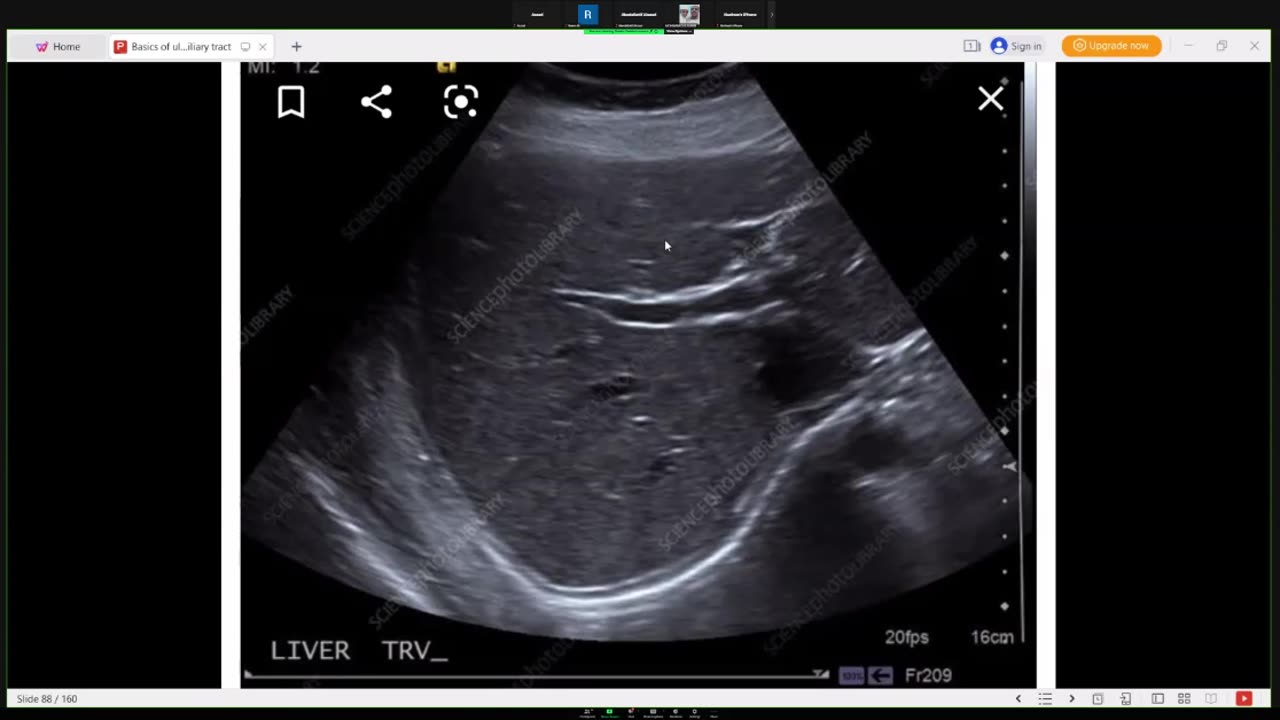 Basics of abdominal ultrasound.mp4