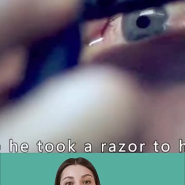 A man challenges baldness