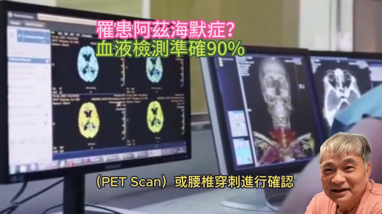 罹患阿茲海默症？ 血液檢測準確90%