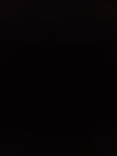 Restless legs syndrome