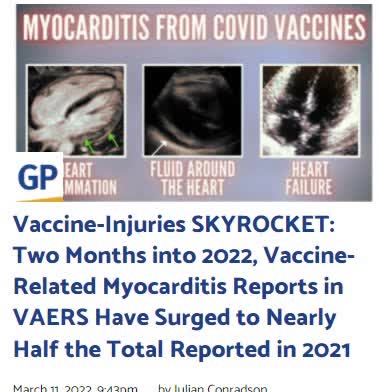 Vaccine-Injuries SKYROCKET: Two Months into 2022, Vaccine-Related Myocarditis Reports