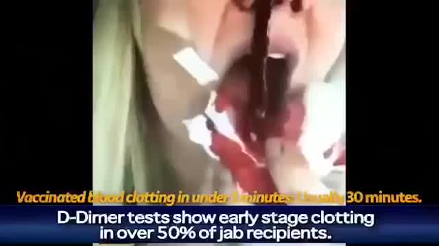 Over 400 Athletes Dead in 6 Months