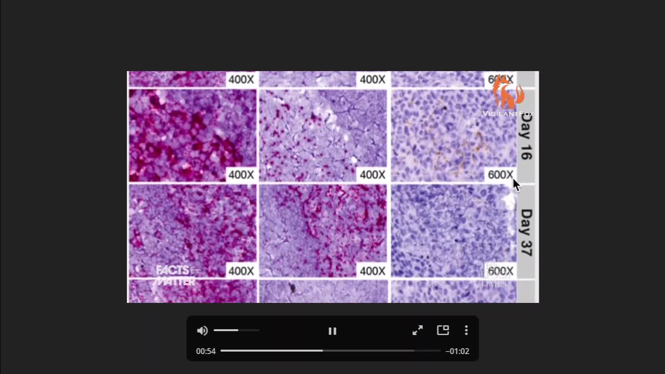 Vaccine's SYNTHETIC EURODINE impact on Immune System - Dr. Ryan Cole