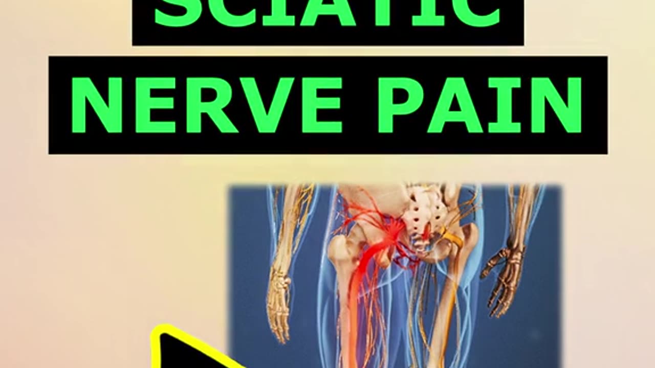 Top 3 remedies for sciatic nerve pain