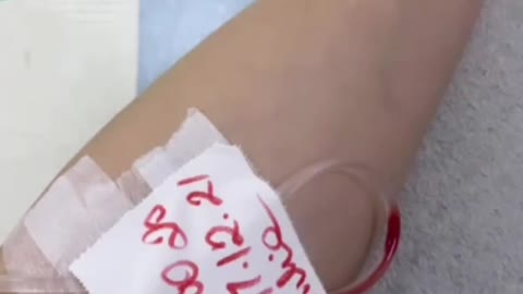 Mais uma vítima de coagulação pós picada