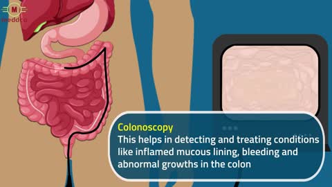 Gastrointestinal Endoscopy