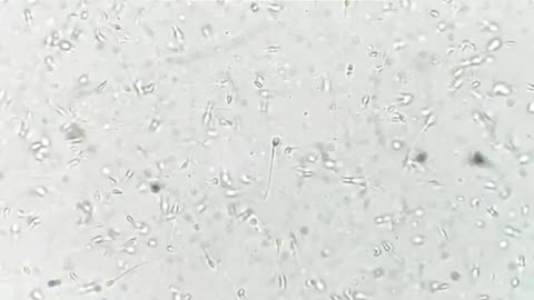 Human sperm cells