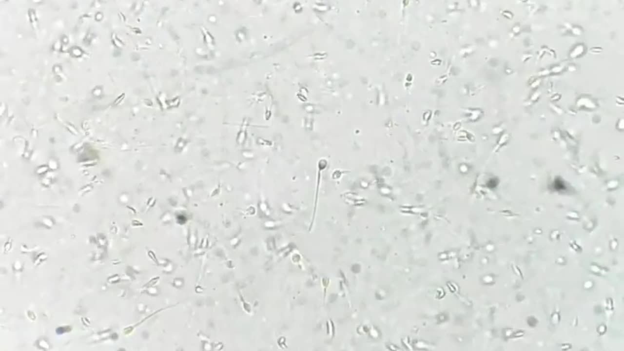 Human sperm cells