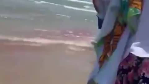 Took Off Her Whole Calve Woman Gets Bitten By A Shark In Texas