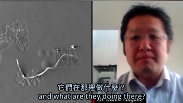 加拿大籍醫生 Dr. Nagase 親自做疫苗實驗光譜分析報告發現二個mRNA疫苗液體有大量的碳和氧,而它們是石墨稀的材質⋯其目的是什麼?
