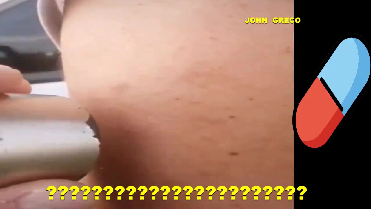 ΚΑΤΙ.... ΒΡΗΚΑΝ... ΟΙ... ΡΩΣΟΙ !!🇷🇺☝☝🔥💊👀☝☝