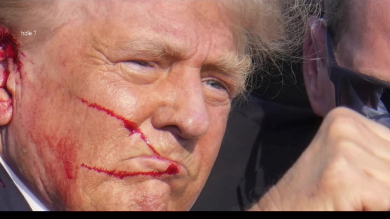 TRUMP's EAR WOUND 🩸👂🏼