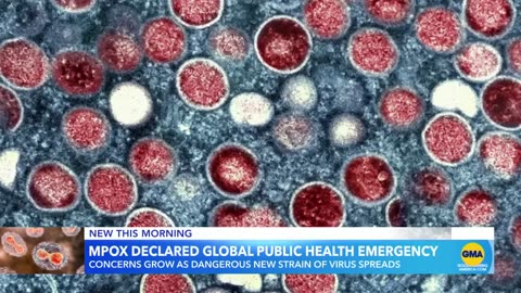 World Health Organization declares mpox public health emergency