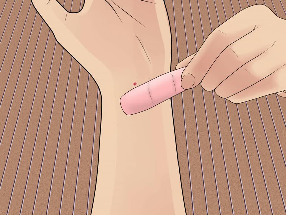 🔴🔴😱👉👉Treat a Cat Bite