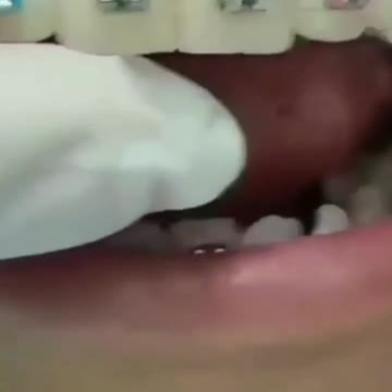 EL DENTISTA.....