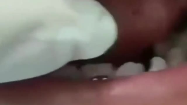 EL DENTISTA.....