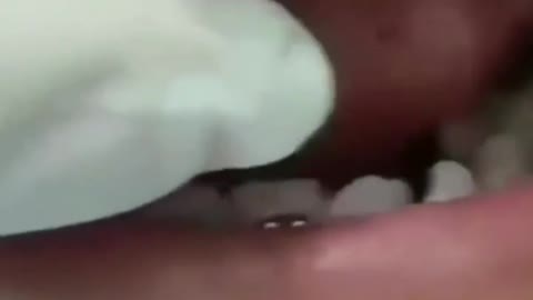 EL DENTISTA.....