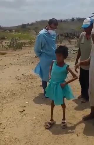 Niños con desnutrición