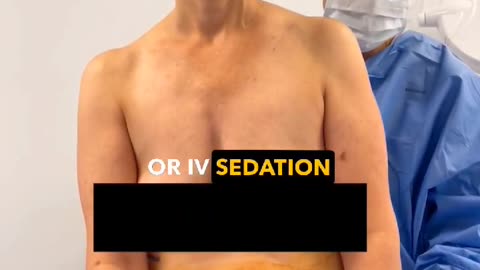 Awake Liposuction with Dr. Kenneth Kim: Precision in Every Step - Part 2