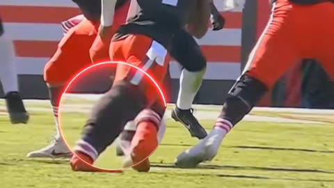Deshaun Watson is down with an apparent Achilles injury