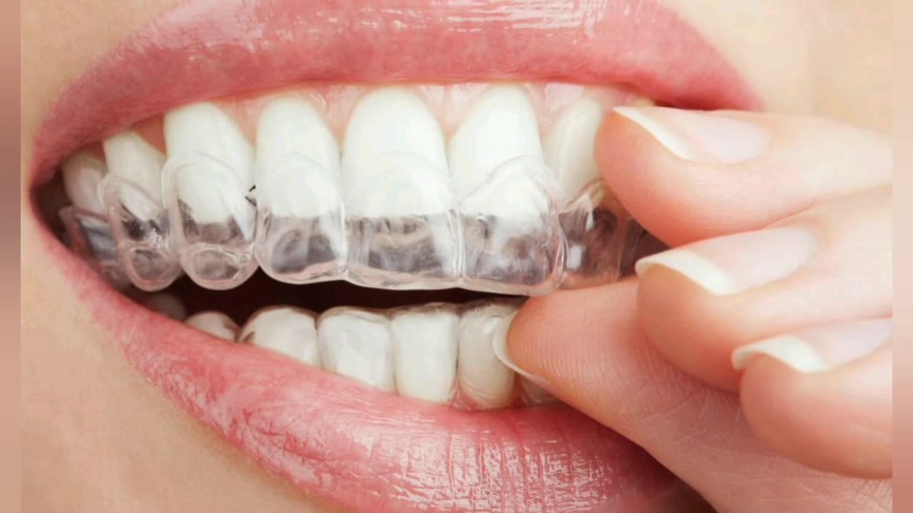 How to make your teeth white.