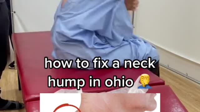 How do you correct a hunchback in Ohio