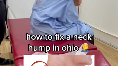 How do you correct a hunchback in Ohio