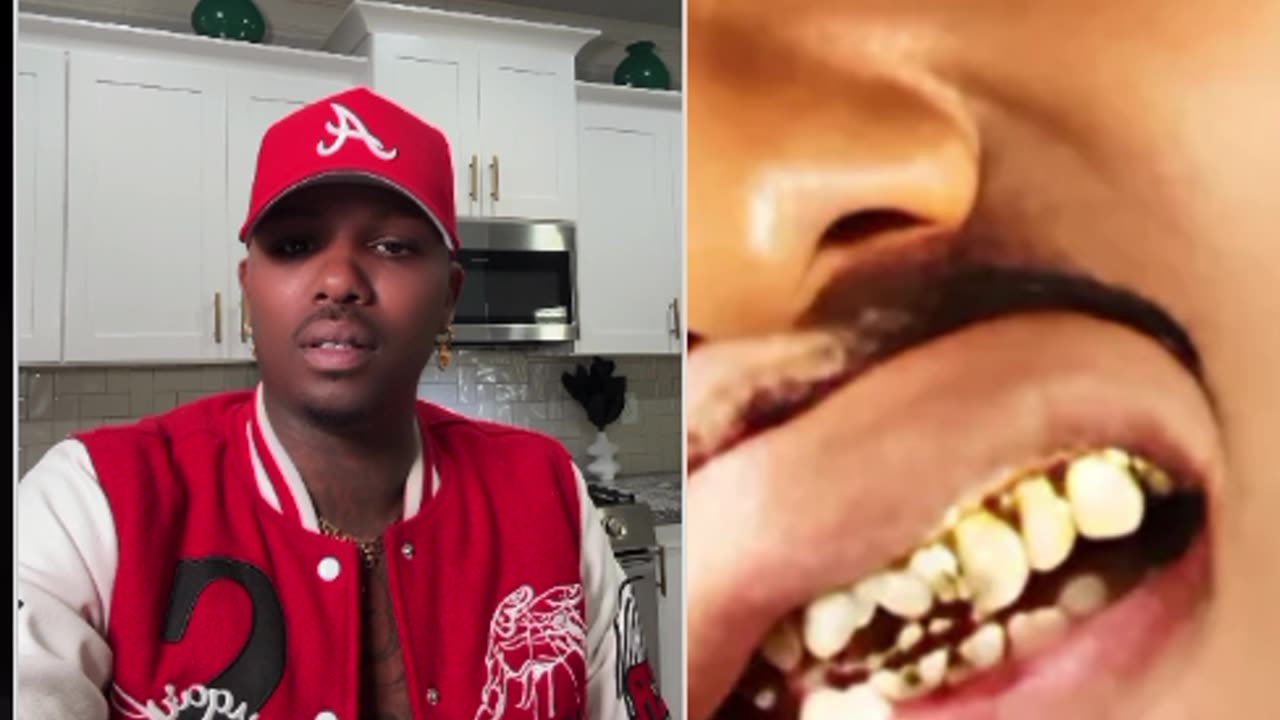 Marquise Pops In Supa Live Supa Asked Questions