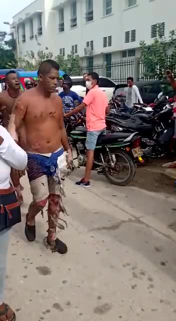 Atención: Decenas de personas resultaron quemadas luego de que explotara un camión cisterna