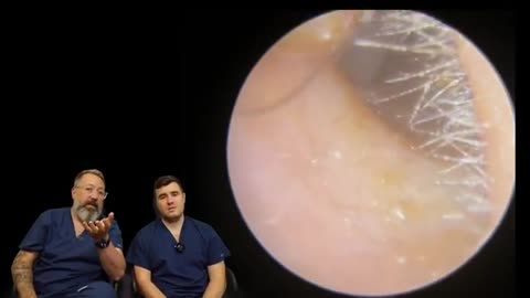 OPERA SINGERS STICKY EAR WAX REMOVAL - EP7