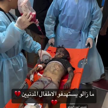 Child casualties of Israeli bombing in Gaza hospital