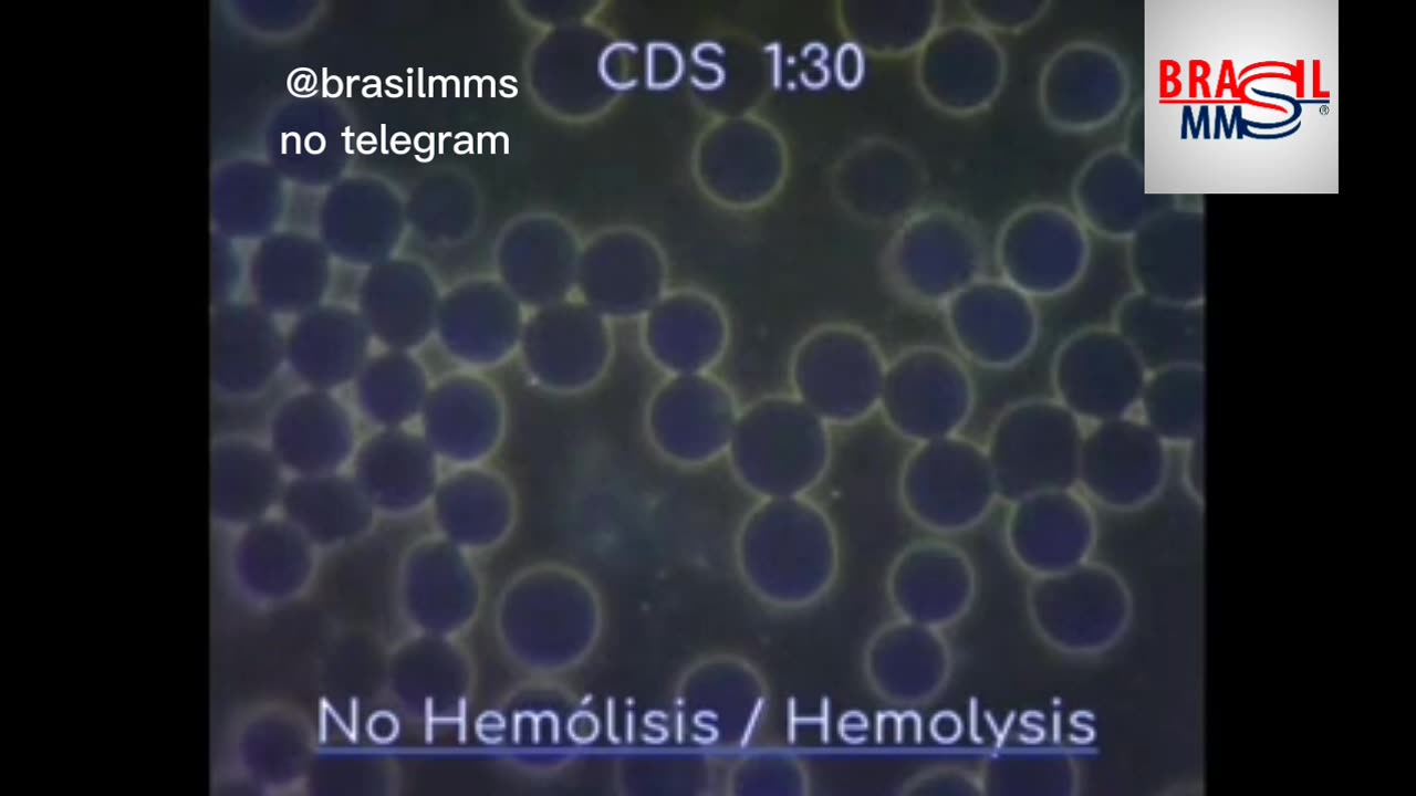 Efeitos do CDS diretamente no sangue, via microscopia de análise de sangue vivo