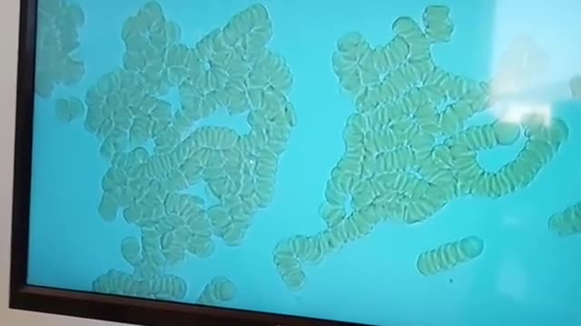 Seconda parte con dott Franco Giovannini grafene nel sangue di Marzia...